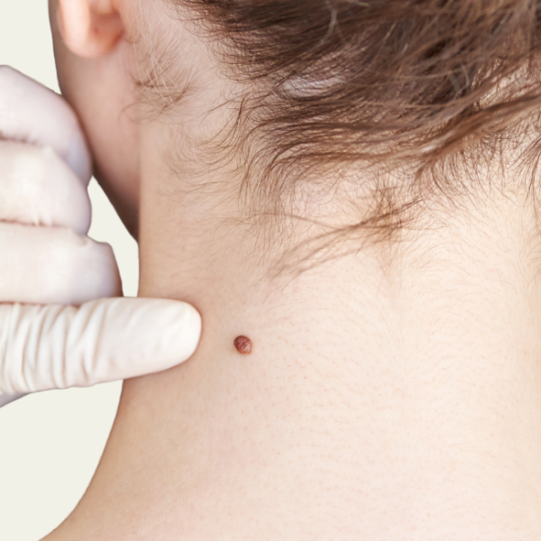 doenças sexualmente transmissíveis (1)